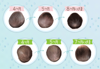 エスメラルダ呼吸する枕の効果
